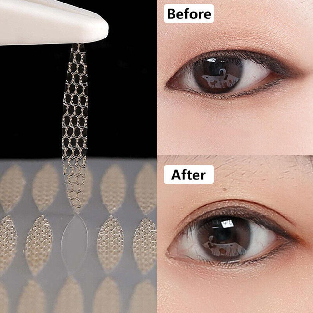 EYELID