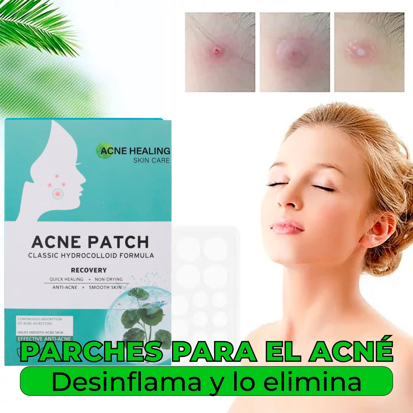 ACNE PATCH